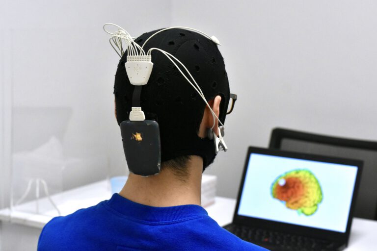 Tdcs Neuromodulaci N Instituto Neurocognitivo Incia