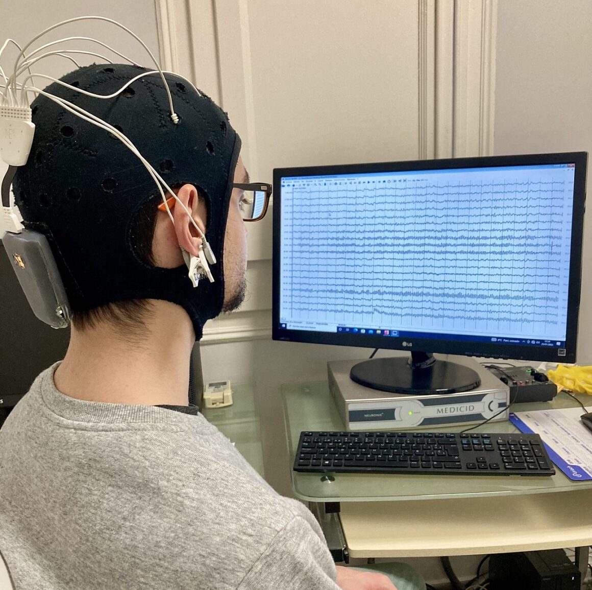 Tdcs Neuromodulación Instituto Neurocognitivo Incia