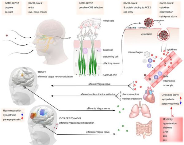 La Neuromodulaci n Cerebral No Invasiva Como Ayuda Para El S ndrome 