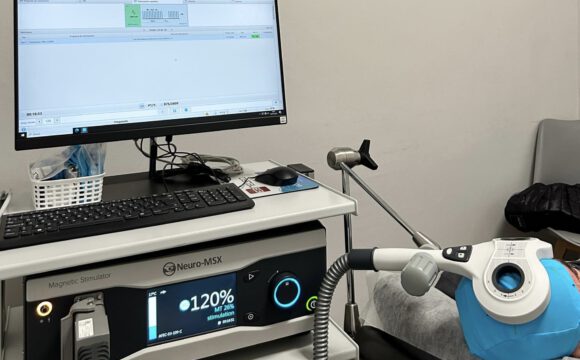 Estimulación cerebral no invasiva: una nueva esperanza para la salud mental